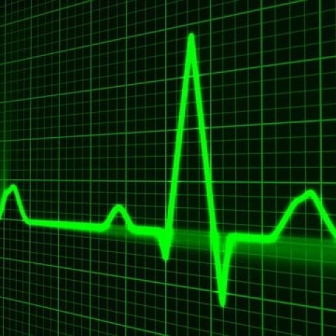 Strengths and Weaknesses of Fundamental & Technical Analysis